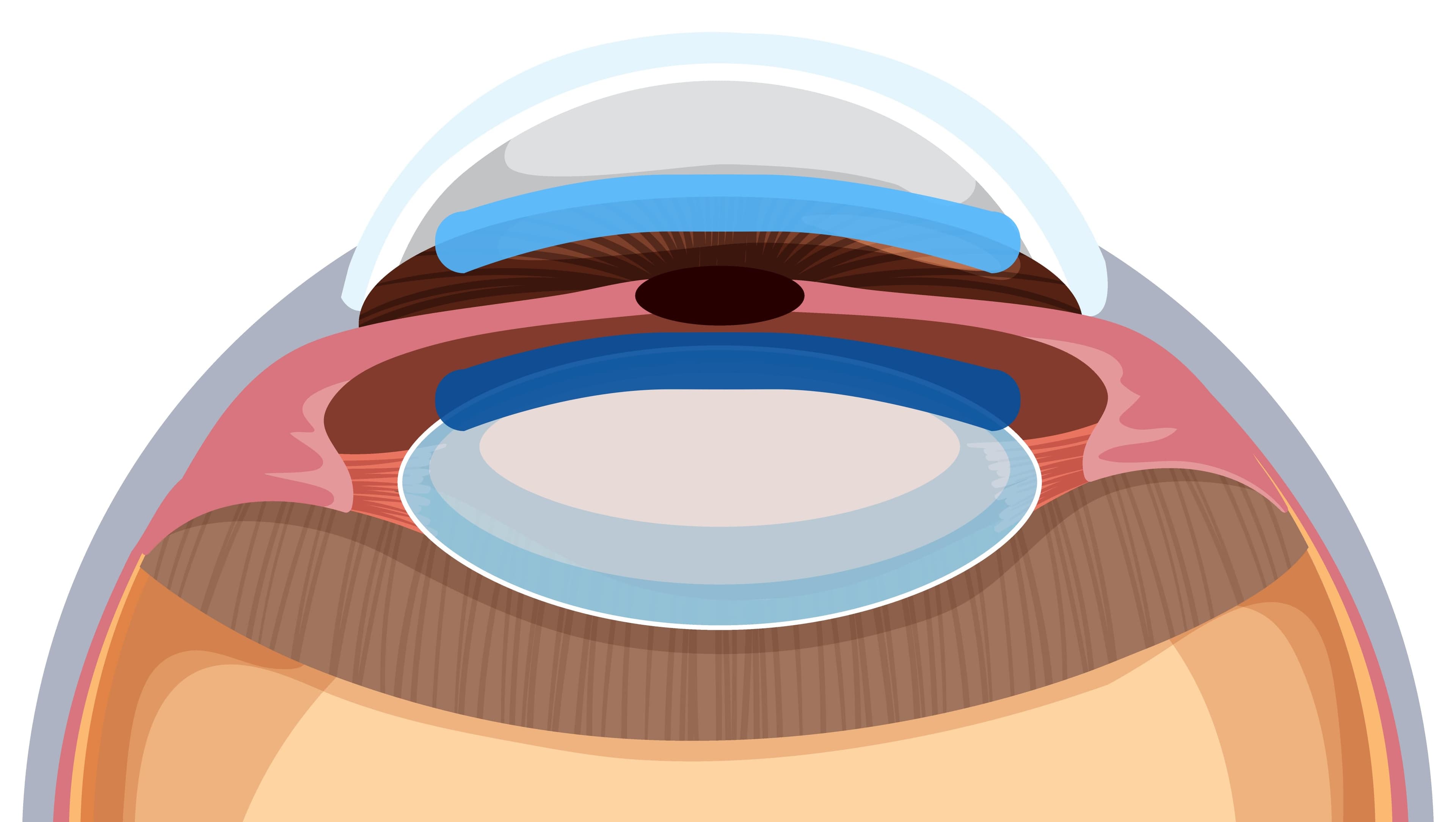 전방렌즈와 후방렌즈 위치 비교