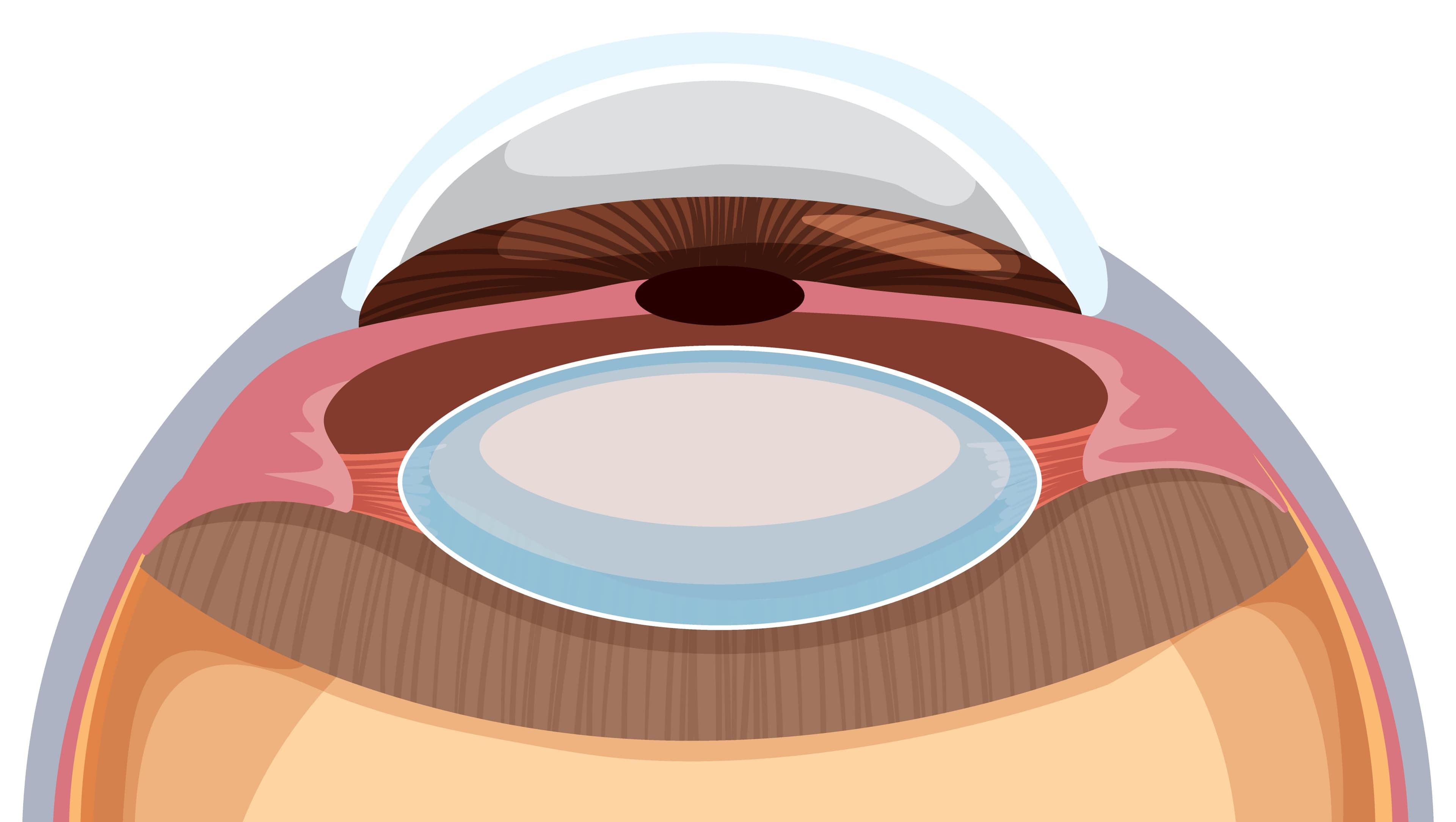 수술 전 눈 상태